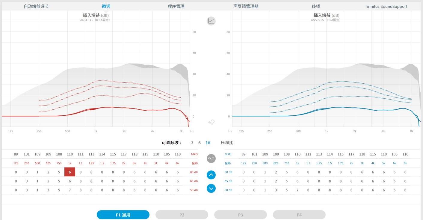 助听器调试界面