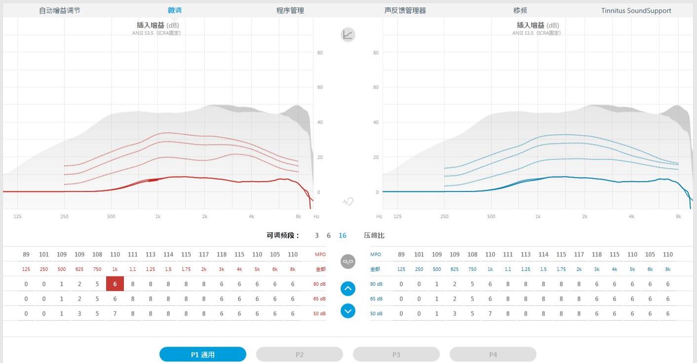 效果好的助听器验配流程有哪些