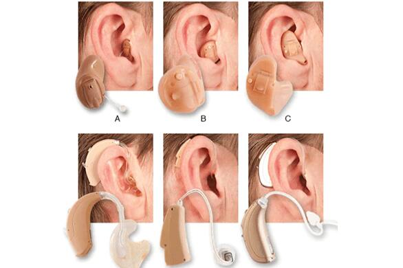 助听器300元和上万的区别：一场听力的奢华之旅