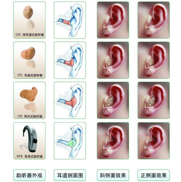 助听器有哪几种类型